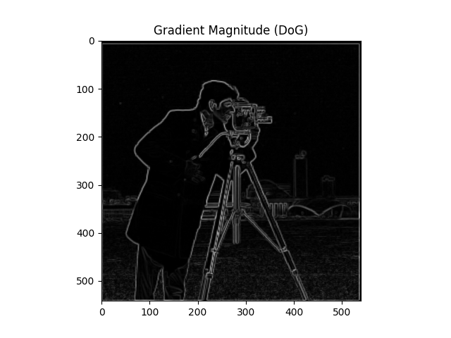 DoG Gradient Magnitude.png